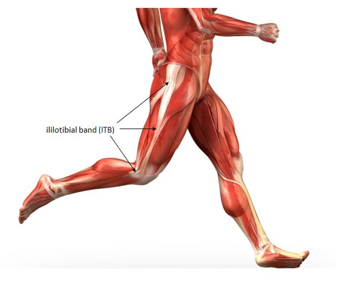 Syndrome: it Causes Band The shoes 5 syndrome Top band Solutions  IT for and