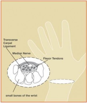 Photo credit: American Society for Surgery of the Hand