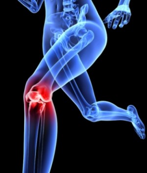 What to expect after knee replacement surgery