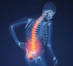 xray lower back pain