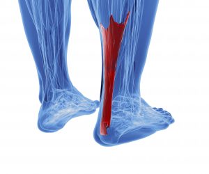 achilles tendon pain and injuries