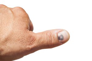 4 Common Fingertip Injuries