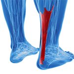 Achilles Tendinitis in Gymnasts