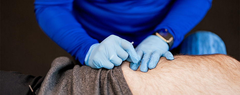 3 Conditions You Didn’t Know Dry Needling Can Help