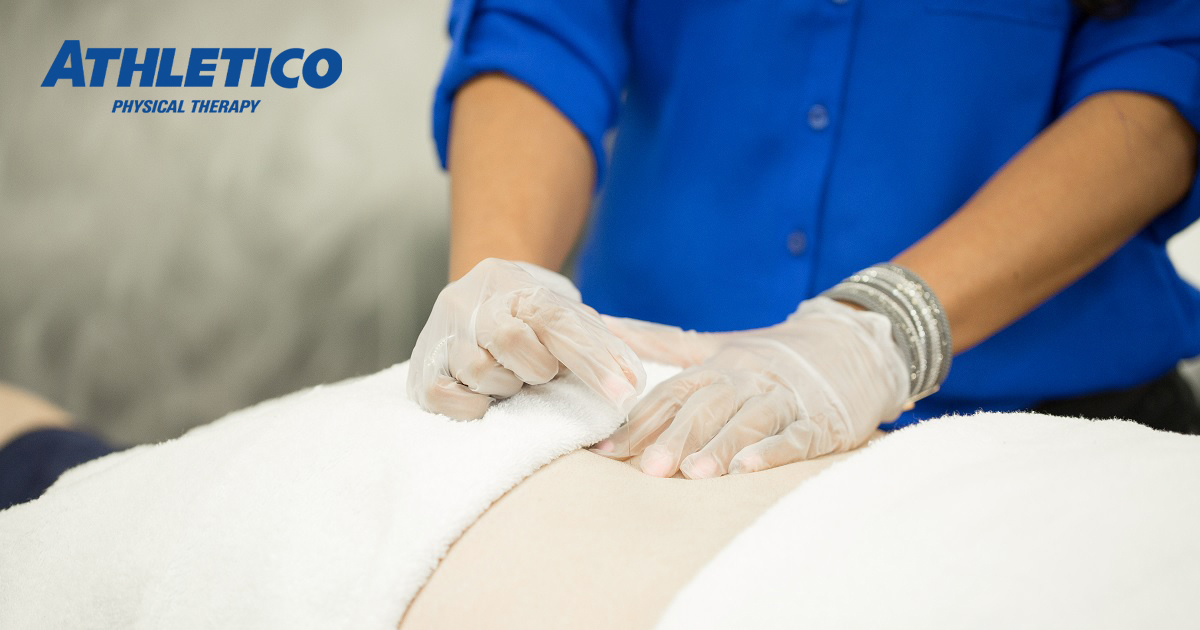Can Dry Needling Help Sciatica Pain? Athletico