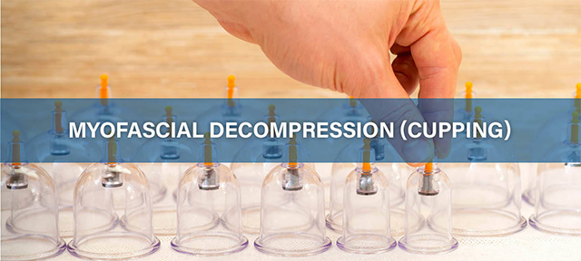 Myofascial Decompression Cupping