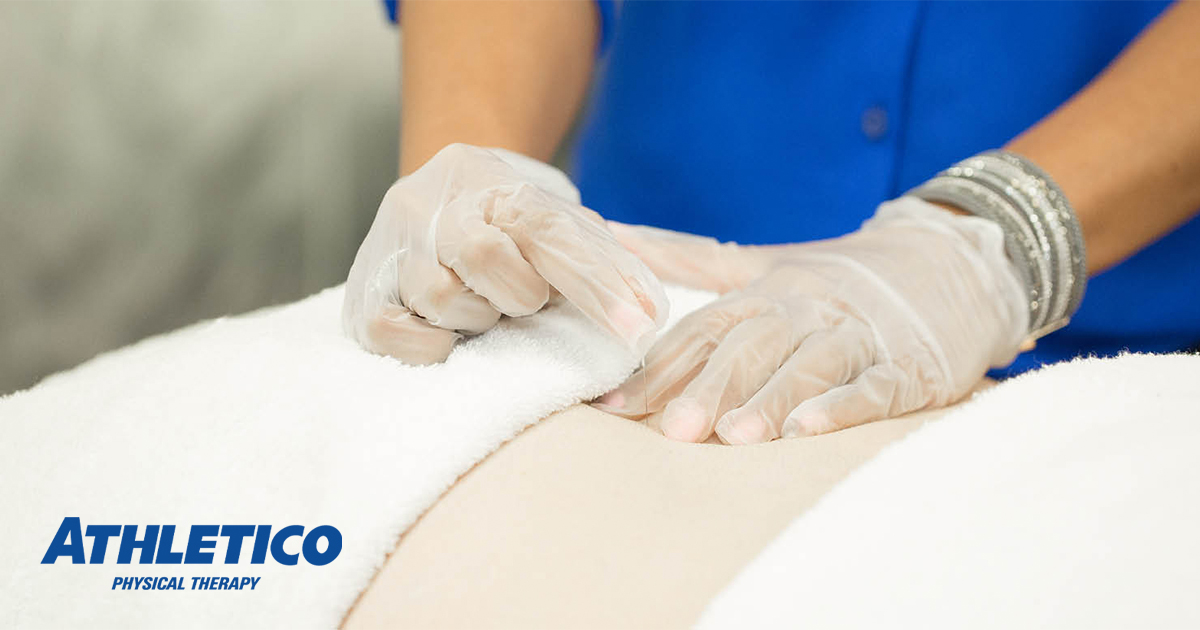 Celebrating Athletico's Newest Dry Needling Certified Clinicians